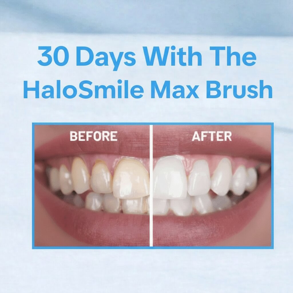 HaloSmile Max