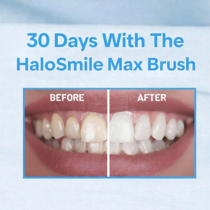 HaloSmile Max
